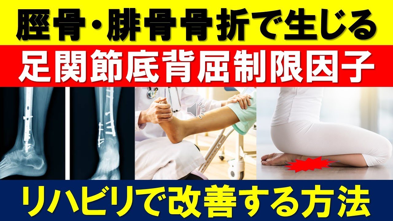 本日は捻挫や脛骨腓骨骨折後に必ずといっていいほど制限になりや